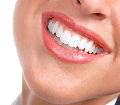 Zoom Teeth Whitening Zoom Teeth Whitening
